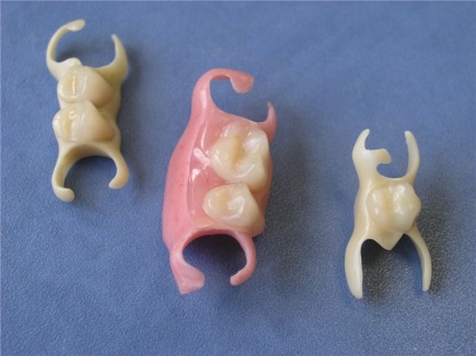 Микропротез 1-3 зуба