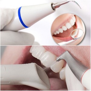 Проведение профессиональной гигиены (ультразвуковая  чистка + механическая ) (1 зуб)